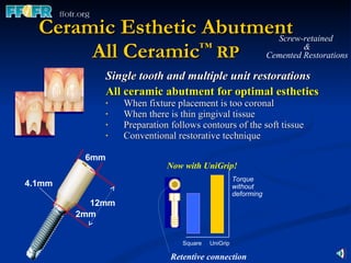 Ceramic Esthetic Abutment All Ceramic ™  RP Single tooth and multiple unit restorations All ceramic abutment for optimal esthetics When fixture placement is too coronal When there is thin gingival tissue Preparation follows contours of the soft tissue  Conventional restorative technique Screw-retained  & Cemented Restorations 6mm 12mm 2mm 4.1mm Now with UniGrip! Torque without deforming Square  UniGrip Retentive connection 