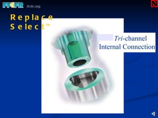 New  Tri -channel  Internal Connection Replace   Select  