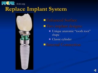 Replace Implant System Enhanced Surface Two implant designs:  Unique anatomic “tooth root” shape  Classic cylinder Internal Connection 