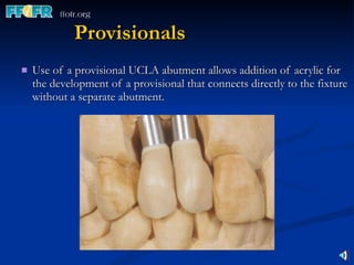 Provisionals Use of a provisional UCLA abutment allows addition of acrylic for the development of a provisional that connects directly to the fixture without a separate abutment. 