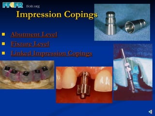 Abutment Level Fixture Level Linked Impression Copings Impression Copings 