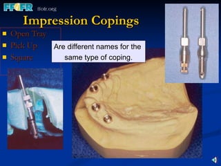 Impression Copings Open Tray  Pick Up  Square Are different names for the  same type of coping. 