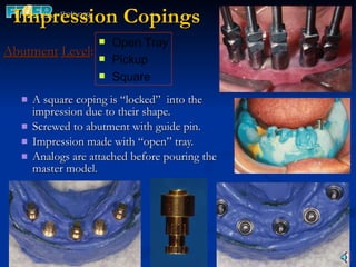 Impression Copings Abutment   Level : A square coping is “locked”  into the impression due to their shape. Screwed to abutment with guide pin. Impression made with “open” tray. Analogs are attached before pouring the master model. Open Tray Pickup Square 