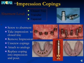 Impression Copings Abutment Level:  Screw to abutment Take impression  with closed tray Remove Impression  Unscrew copings Attach to analogs Replace coping  into impression  and pour. Closed Tray Transfer Tapered 