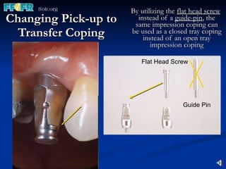 Changing Pick-up to Transfer Coping By utilizing the  flat head screw  instead of a  guide-pin , the same impression coping can be used as a closed tray coping instead of an open tray impression coping Pick-up / with guide pin Guide Pin Flat Head Screw 