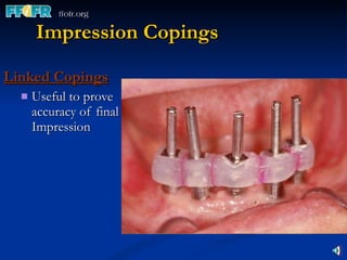 Impression Copings Linked Copings Useful to prove accuracy of final Impression 