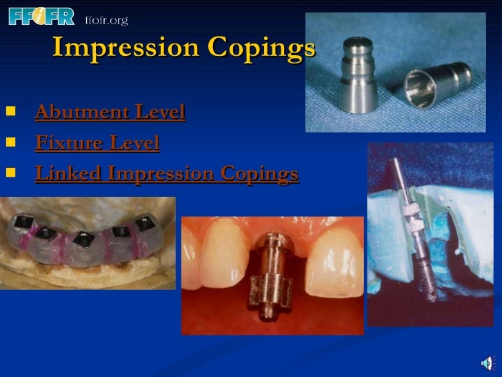 Implant components and basic techniques3
