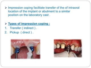 Implant components and function Slide 25