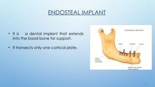 1 0
ENDOSTEAL IMPLANT
• It is a dental implant that extends
into the basal bone for support.
• It transects only one cortical plate.
 