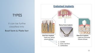 TYPES
It can be further
classified into:
Root form & Plate form
11
 