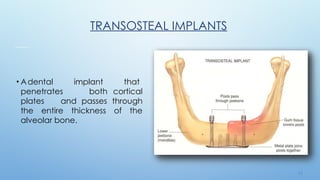 1 2
TRANSOSTEAL IMPLANTS
• Adental implant that
penetrates both cortical
plates and passes through
the entire thickness of the
alveolar bone.
 
