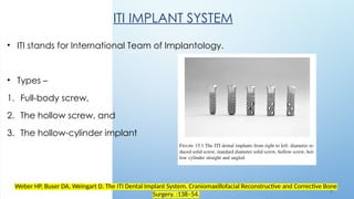 5 1
ITI IMPLANT SYSTEM
• ITI stands for International Team of Implantology.
• Types –
1. Full-body screw,
2. The hollow screw, and
3. The hollow-cylinder implant
Weber HP, Buser DA, Weingart D. The ITI Dental Implant System. Craniomaxillofacial Reconstructive and Corrective Bone
Surgery. :138–54.
 