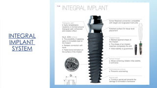 5 9
INTEGRAL
IMPLANT
SYSTEM
 