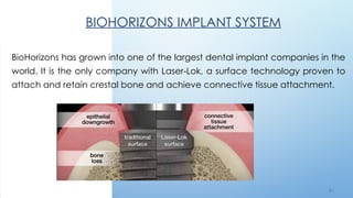 6 2
BIOHORIZONS IMPLANT SYSTEM
BioHorizons has grown into one of the largest dental implant companies in the
world. It is the only company with Laser-Lok, a surface technology proven to
attach and retain crestal bone and achieve connective tissue attachment.
 