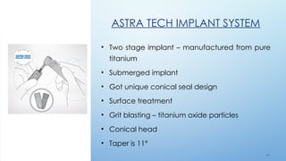 6 7
ASTRA TECH IMPLANT SYSTEM
• Two stage implant – manufactured from pure
titanium
• Submerged implant
• Got unique conical seal design
• Surface treatment
• Grit blasting – titanium oxide particles
• Conical head
• Taper is 11°
 