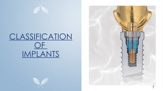 CLASSIFICATION
OF
IMPLANTS
7
 
