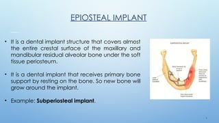 9
EPIOSTEAL IMPLANT
• It is a dental implant structure that covers almost
the entire crestal surface of the maxillary and
mandibular residual alveolar bone under the soft
tissue periosteum.
• It is a dental implant that receives primary bone
support by resting on the bone. So new bone will
grow around the implant.
• Example: Subperiosteal implant.
 