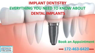IMPLANT DENTISTRY
EVERYTHING YOU NEED TO KNOW ABOUT
DENTAL IMPLANTS
Book an Appointment
172-463-6420
 