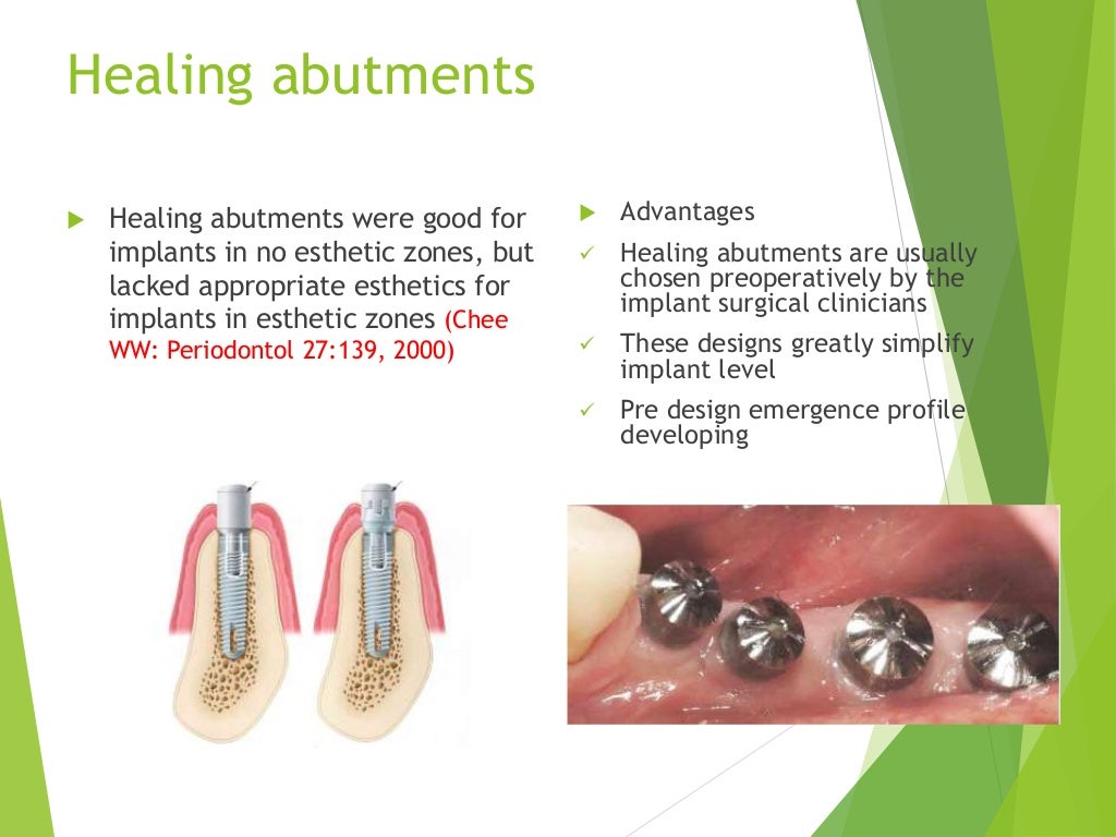 Implant dentistry in esthetic zone