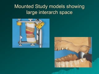 implant diagnosis and treatment planning | PPT