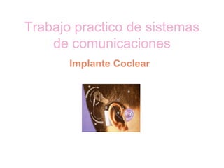 Trabajo practico de sistemas de comunicaciones Implante Coclear  