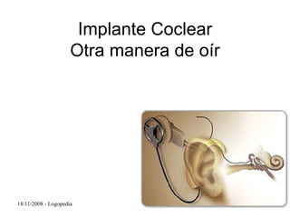 Implante Coclear Otra manera de oír 