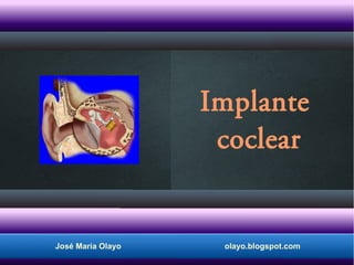 José María Olayo olayo.blogspot.com
Implante
coclear
 