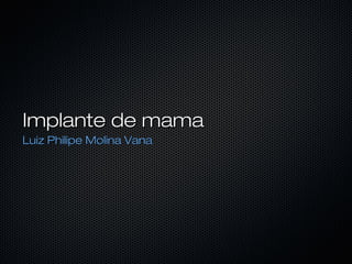 Implante de mama
Luiz Philipe Molina Vana

 