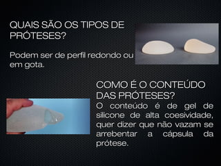 QUAIS SÃO OS TIPOS DE
PRÓTESES?
Podem ser de perfil redondo ou
em gota.

COMO É O CONTEÚDO
DAS PRÓTESES?

O conteúdo é de gel de
silicone de alta coesividade,
quer dizer que não vazam se
arrebentar a cápsula da
prótese.

 