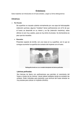 Endoóseos
Estos implantes van introducidos en el hueso alveolar, y según su forma distinguiremos:

Cilíndricos
Por fricción

De superficie no roscada cubierta normalmente por una capa de hidroxiapatita
(retención química), algunos "modelos" tienen perforaciones con el fin de que
el hueso se desarrolle en su interior y se fije (retención mecánica), estos
últimos no son muy usados, pues es muy lento el proceso. Su biomecánica es
peor que los roscados.
Roscados

Presentan aspecto de tornillo, con una rosca en su superficie, con lo que se
consigue aumentar la superficie de contacto del implante con el hueso.

Radiografía donde se ve un modelo deimplante de lámina perforada.

Láminas perforadas
Son láminas de titanio con perforaciones que permiten el crecimiento del
hueso a través de los mismos. Llevan pilares soldados donde se anclarán las
prótesis. Están indicadas para pacientes cuya anchura del hueso alveolar es
muy escasa para colocar un implante cilíndrico.

 