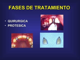FASES DE TRATAMIENTO   QUIRURGICA PROTESICA 