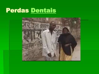 Perdas Dentais