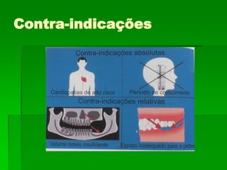 Contra-indicações