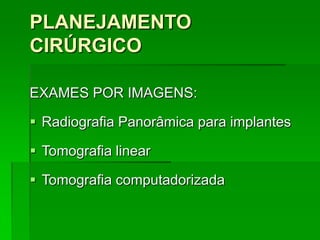 PLANEJAMENTO CIRÚRGICOEXAMES POR IMAGENS:Radiografia Panorâmica para implantes