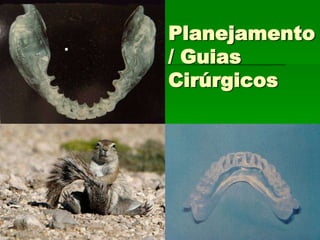 Opções de PrótesePrótese Parcial Fixa Associado a RemovívelPrótese Parcial FixaPrótese Parcial RemovívelPrótese TotalPrótese Sobre Implantes	Unitária	Vários Elementos	Overdenture