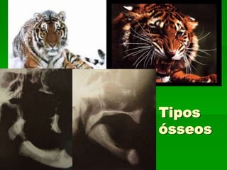 Diâmetros de Implantes