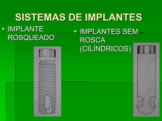 Tipos de implantes