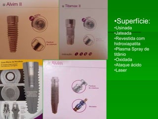 SISTEMAS DE IMPLANTESIMPLANTE ROSQUEADOIMPLANTES SEM ROSCA (CILÍNDRICOS)Superfície: