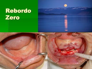 Tomografia computadorizada