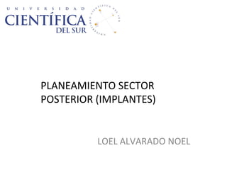 LOEL ALVARADO NOEL
PLANEAMIENTO SECTOR
POSTERIOR (IMPLANTES)
 
