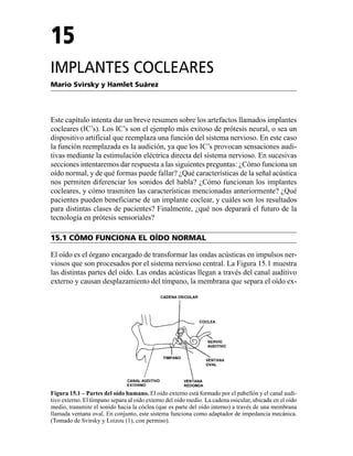 Implantes Cocleares