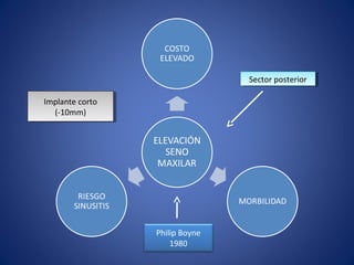 Sector posterior
                                  Sector posterior

Implante corto
 Implante corto
   (-10mm)
    (-10mm)




                  Philip Boyne
                      1980
 
