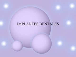 IMPLANTES DENTALES 