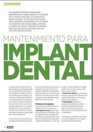 Mantenimientos de Implantes Dentales