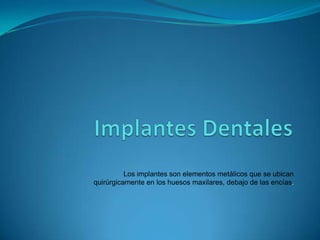 Los implantes son elementos metálicos que se ubican
quirúrgicamente en los huesos maxilares, debajo de las encías.
 