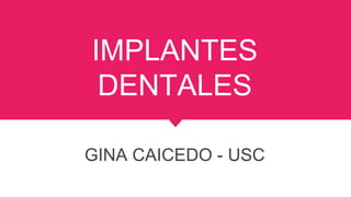 IMPLANTES
DENTALES
GINA CAICEDO - USC
 