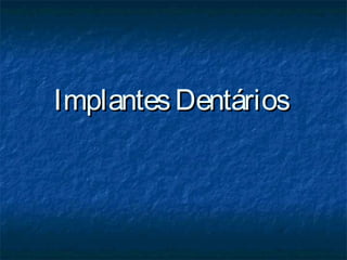 ImplantesDentáriosImplantesDentários
 