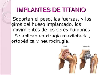IMPLANTES DE TITANIOIMPLANTES DE TITANIO
Soportan el peso, las fuerzas, y los
giros del hueso implantado, los
movimientos de los seres humanos.
Se aplican en cirugía maxilofacial,
ortopédica y neurocirugía.
 