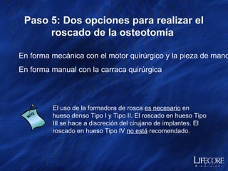 Paso 5: Dos opciones para realizar el roscado de la osteotomía  El uso de la formadora de rosca  es necesario  en hueso denso Tipo I y Tipo II. El roscado en hueso Tipo III se hace a discreción del cirujano de implantes. El roscado en hueso Tipo IV  no está  recomendado. En forma mecánica con el motor quirúrgico y la pieza de mano 