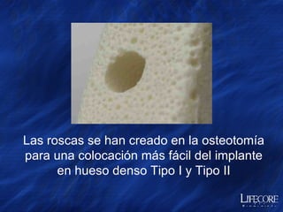 Asegúrese de que el Adaptador de Carraca permanezca completamente asentado sobre la Formadora de Rosca Quirúrgica Paso 6: Coloque el Adaptador de Carraca sobre la Formadora de Rosca de 13mm Completamente asentado  13mm Realice el roscado al hueso hasta la línea negra de 13mm 13mm 